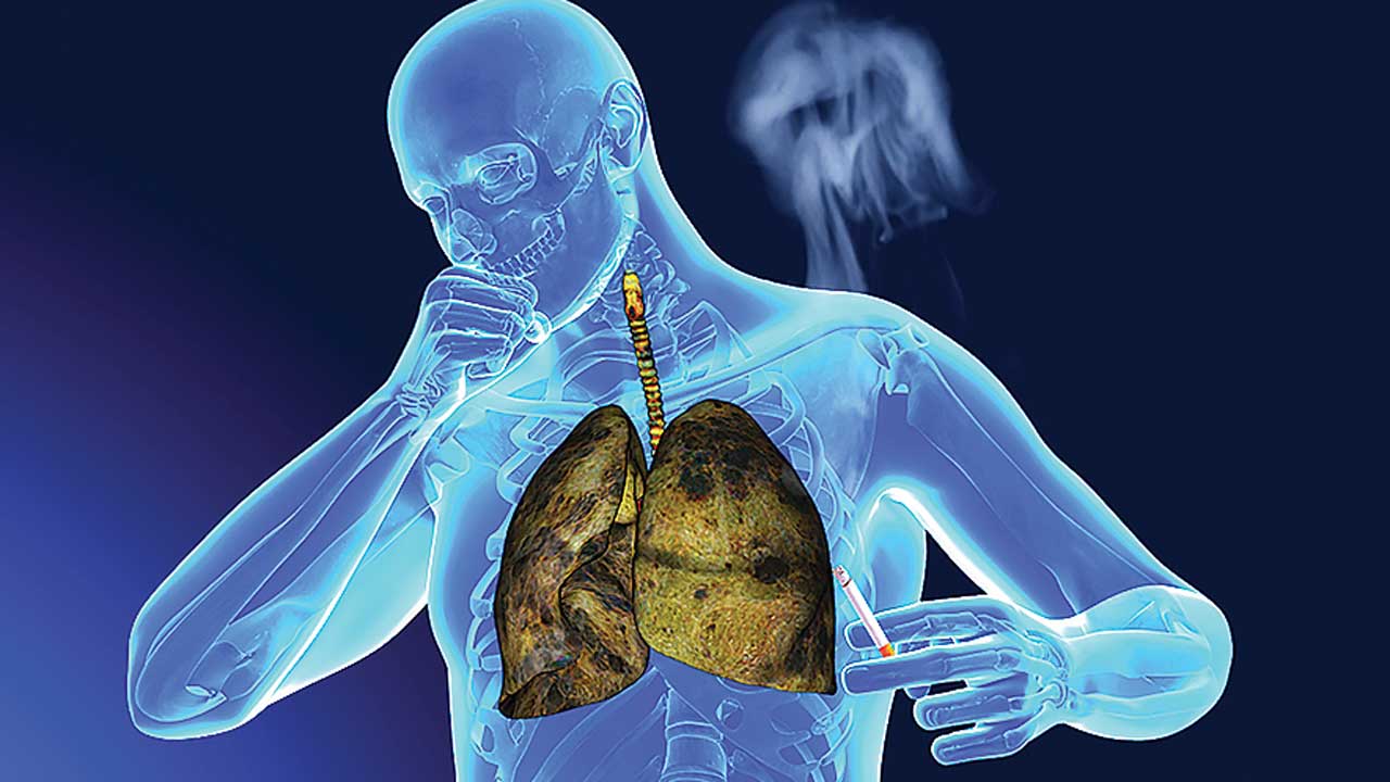 lung cancer screening